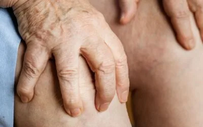 Recent Advances in Antigout Medications