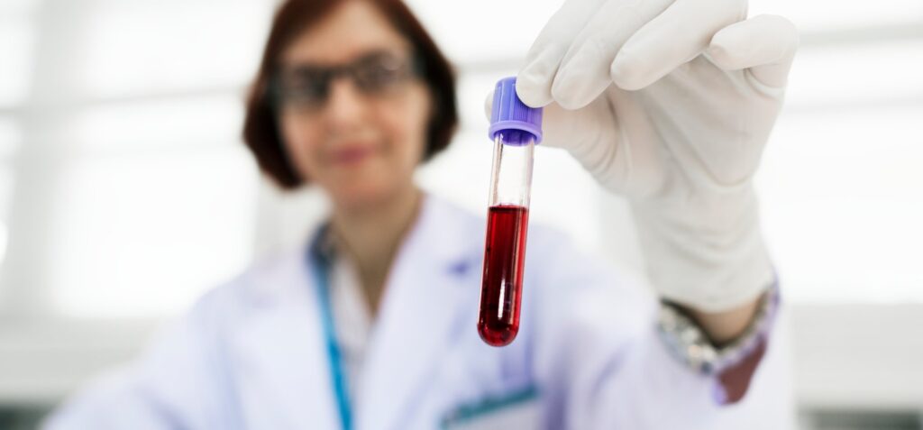 Doctor holding blood sample