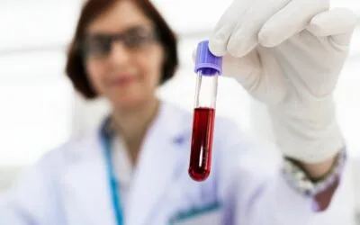 The Role of Iron Chelators in Managing Iron Overload Disorders