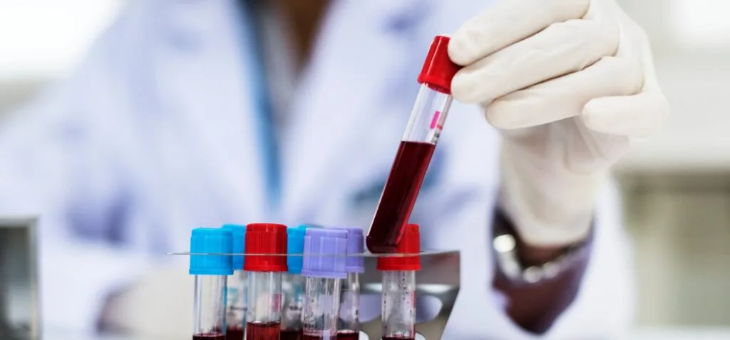 Doctor checking blood samples